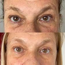 LumiEyes™ Mirada divina