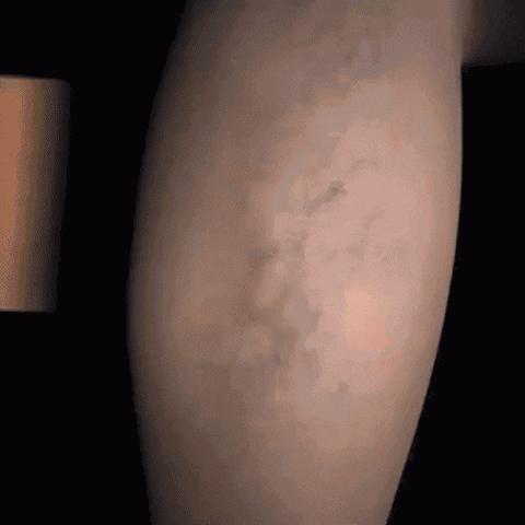 AuraLegs™ –Energía y Bienestar