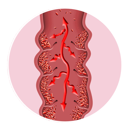 AuraLegs™ –Energía y Bienestar