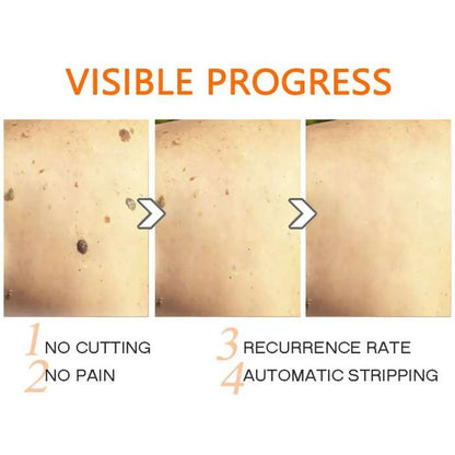 LumiDerm™ Belleza Natural